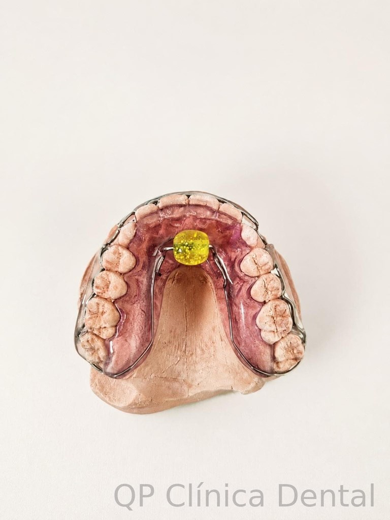 No todos los problemas de ortodoncia empiezan en los dientes 